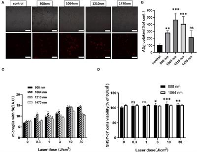 Synergistic photobiomodulation with 808-nm and 1064-nm lasers to reduce the β-amyloid neurotoxicity in the in vitro Alzheimer's disease models